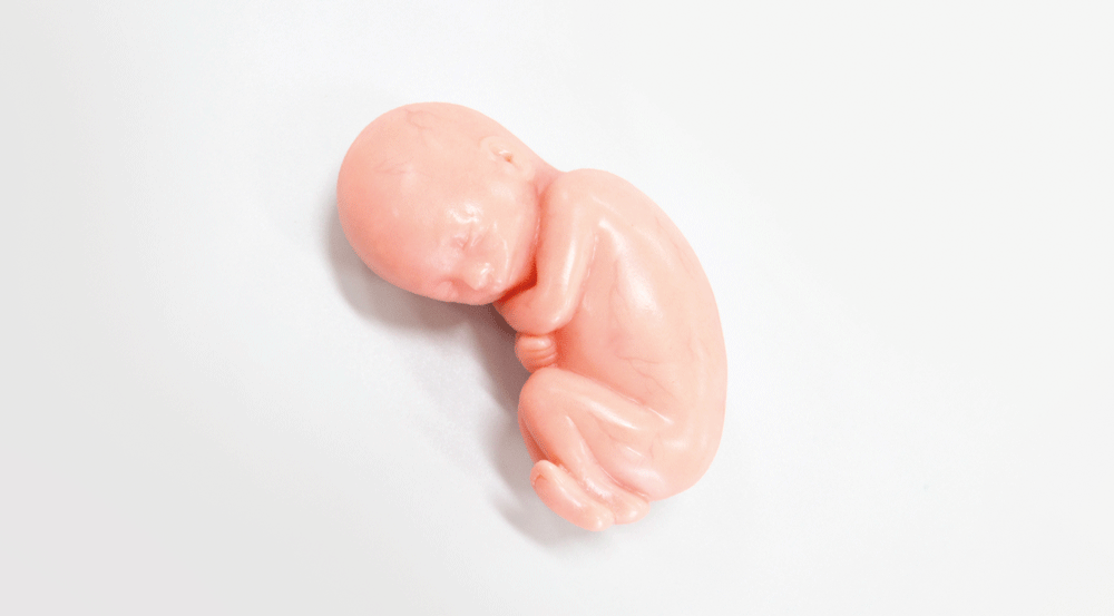 Aborto